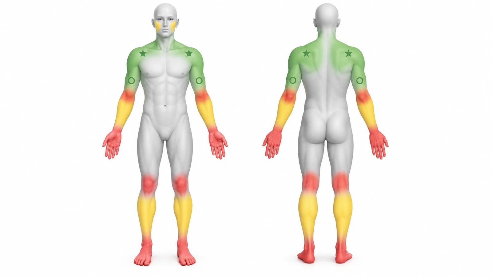 Silhouettes du corps de face et de dos codées par couleur : vert sur les épaules, le haut du dos et l’intérieur des avant-bras, jaune sur l’extérieur des avant-bras et les mollets, et rouge sur les mains, les doigts, les poignets, les coudes, les genoux et les pieds